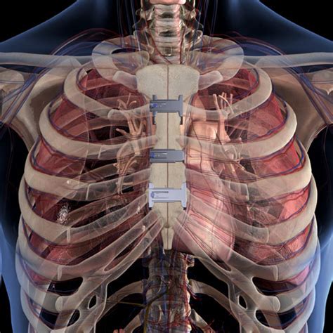 Breastbone mechanics - Mission magazine | UT Health Science Center San ...