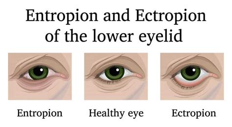 Entropion and Ectropion in Dogs – Top Lap Dogs