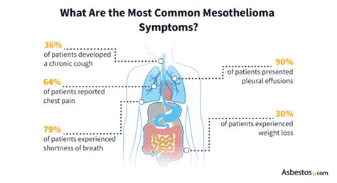 Signs and Symptoms of Mesothelioma | Do I Have Mesothelioma?