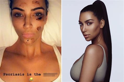 Kim Kardashian gives fans intimate look at doctor's visit to treat her ...