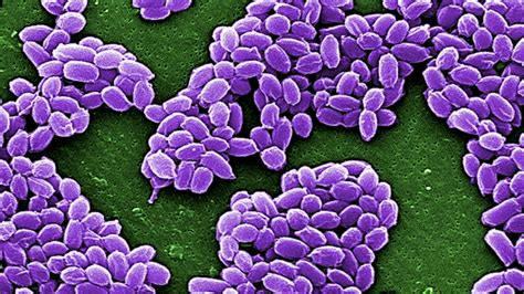 CDC Investigates Live Anthrax Shipments : Shots - Health News : NPR