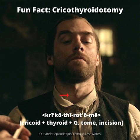 Fun Fact: Cricothyroidotomy – Outlander Anatomy