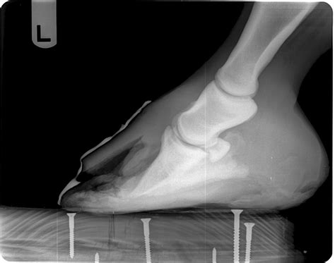 Innovative Equine Podiatry: Severe White line disease case.