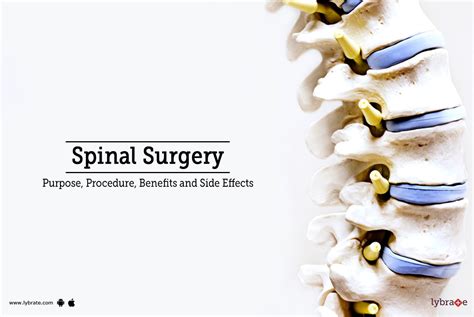 Spinal Surgery: Types, Recovery, Risks, and Benefits