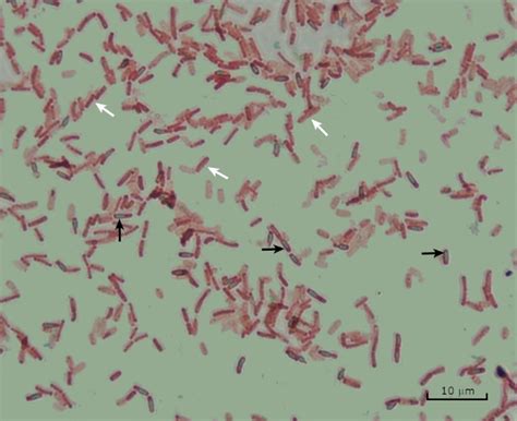 Microscopía y tinción: Tinción de Gram, cápsula y endosporas (video) | JoVE