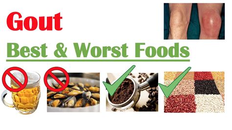 Best & Worst Foods to Eat with Gout | Reduce Risk of Gout Attacks and ...