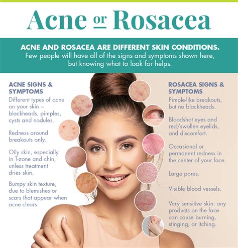 Acne OR Rosacea? The Differences Between These Skin Conditions ...