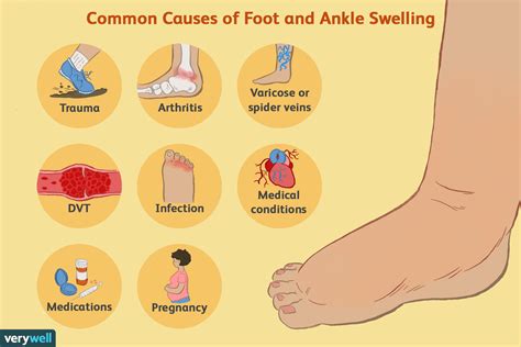 7 causes of swelling and water retention and what to do – Artofit