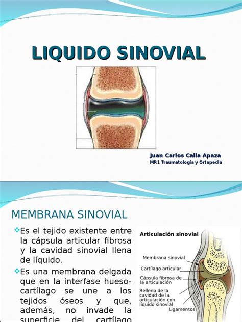 LIQUIDO SINOVIAL | Inflamación | Citocina