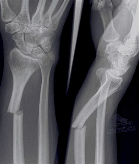 Why Don't You Take X-rays? - Cornerstone Therapy & Wellness