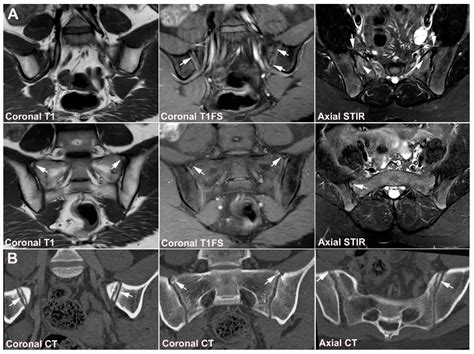 JCM | Free Full-Text | Diagnostics of Sacroiliac Joint Differentials to ...