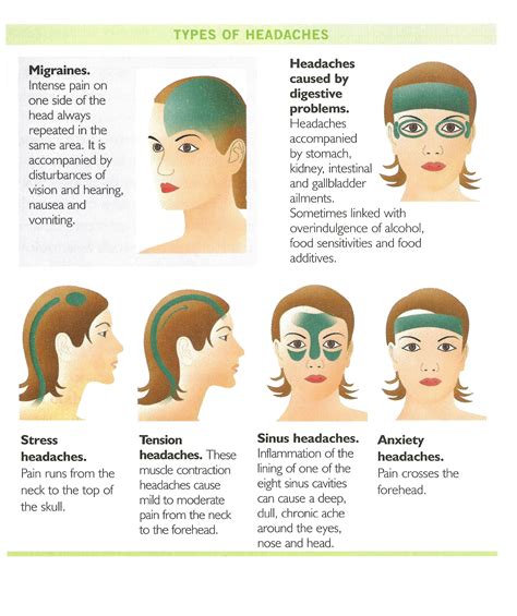 Useful guide for massage therapists and self care for headache massage ...