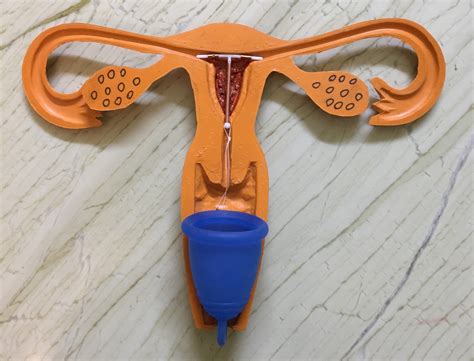 Using A Menstrual Cup And IUD: What You Need To Know