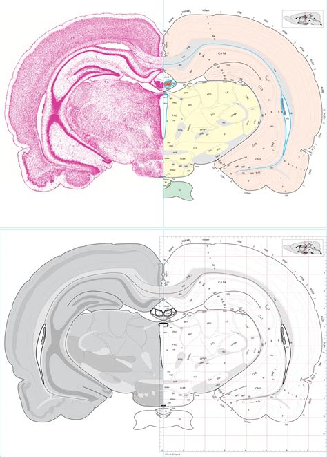 Rat Brain Anatomy - Anatomy Reading Source