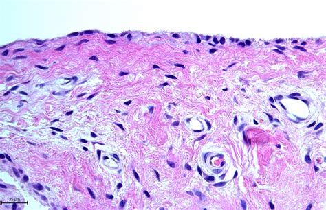 Synovial Membrane Histology