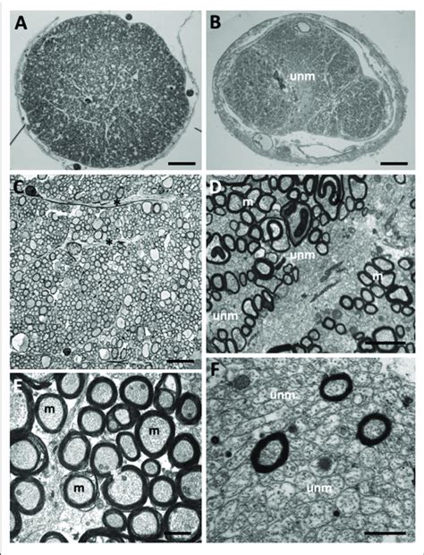 Unmyelinated Axon