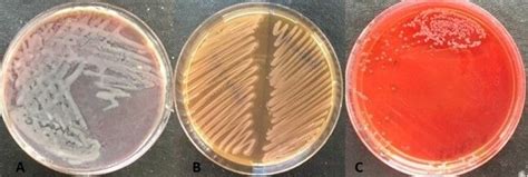 Colony morphology of Proteus spp. on XLD (A), MacConkey (B), and blood ...