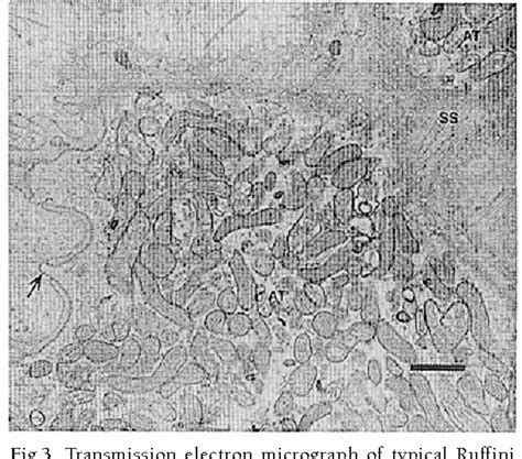 [PDF] Morphological Changes of Ruffini Nerve Endings in the Periodontal ...