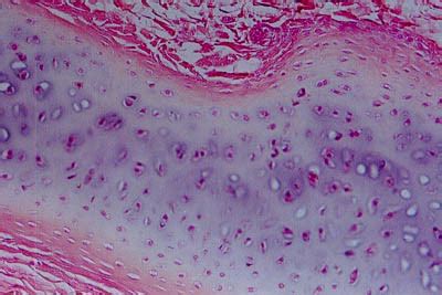 Cartilage Histology - Hyaline cartilage - histology slide