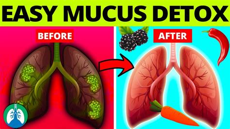 How To Cure Mucus - Sheetfault34