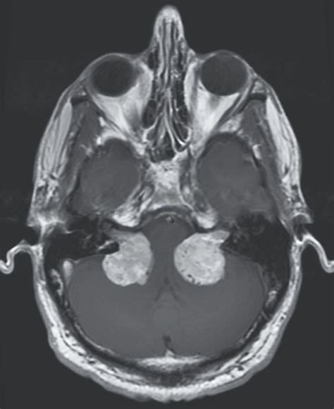 Image Challenge | NEJM | Medicine journal, Medicine, Clinic