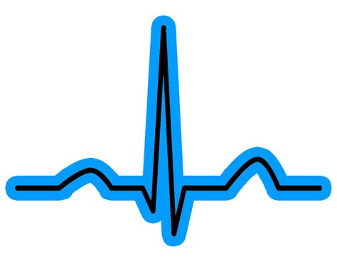 Heart Rhythm Guide. Heart Rhythm, Heart Rate, and Pacemaker Information ...