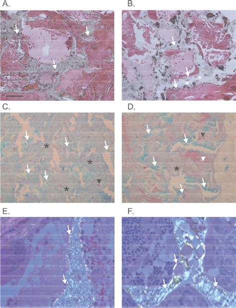 Scaffold appearance upon implantation. Nuclear fast red staining of the ...