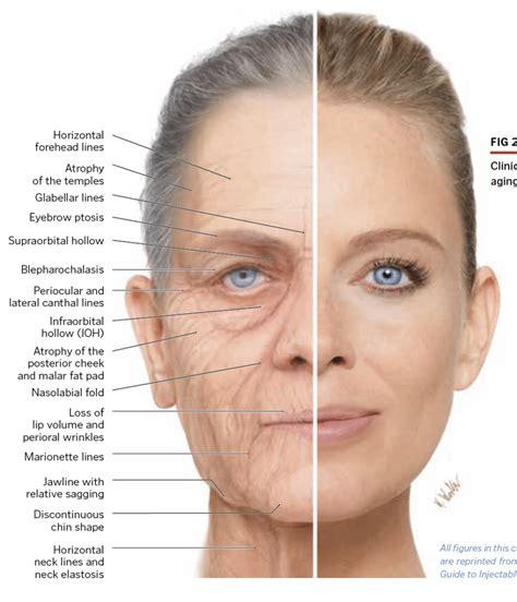 Basics to Facial Esthetics - Facial anatomy - CARE Esthetics