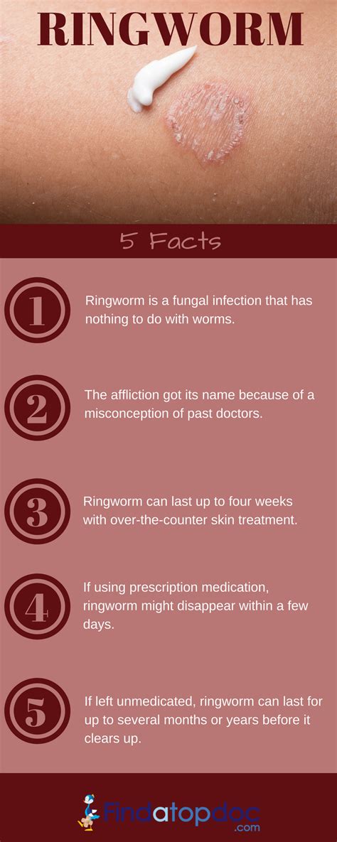 Ringworm Treatment: Type of Treatment and Natural Home Remedies