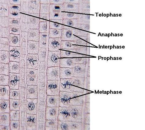 noioso peccato alga marina stages of mitosis under microscope ...