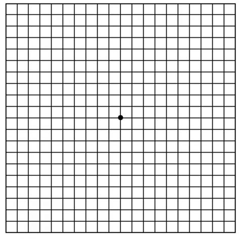 Macular Degeneration Grid Chart To Test Eyes