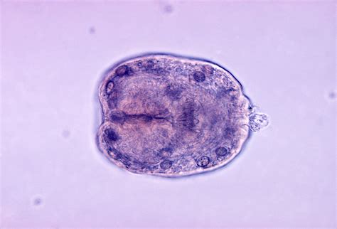 Echinococcus. Causes, symptoms, treatment Echinococcus