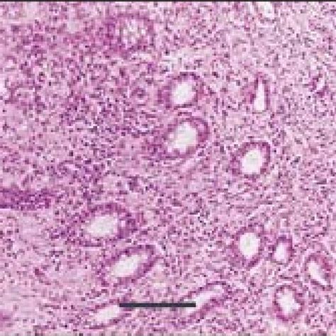 Histiocytic Ulcerative Colitis In Dogs Symptoms Causes