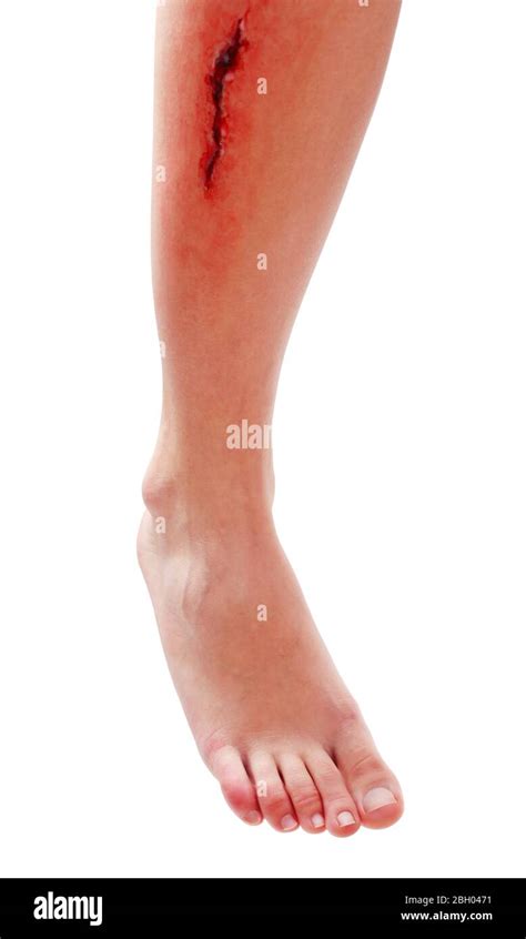 Injured leg with blood isolated on white Stock Photo - Alamy