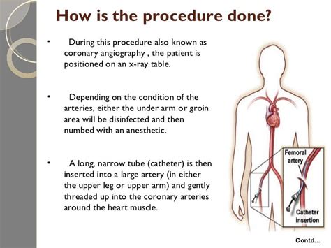 Angiogram