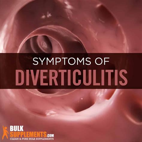 Diverticulitis: Symptoms, Causes & Treatment