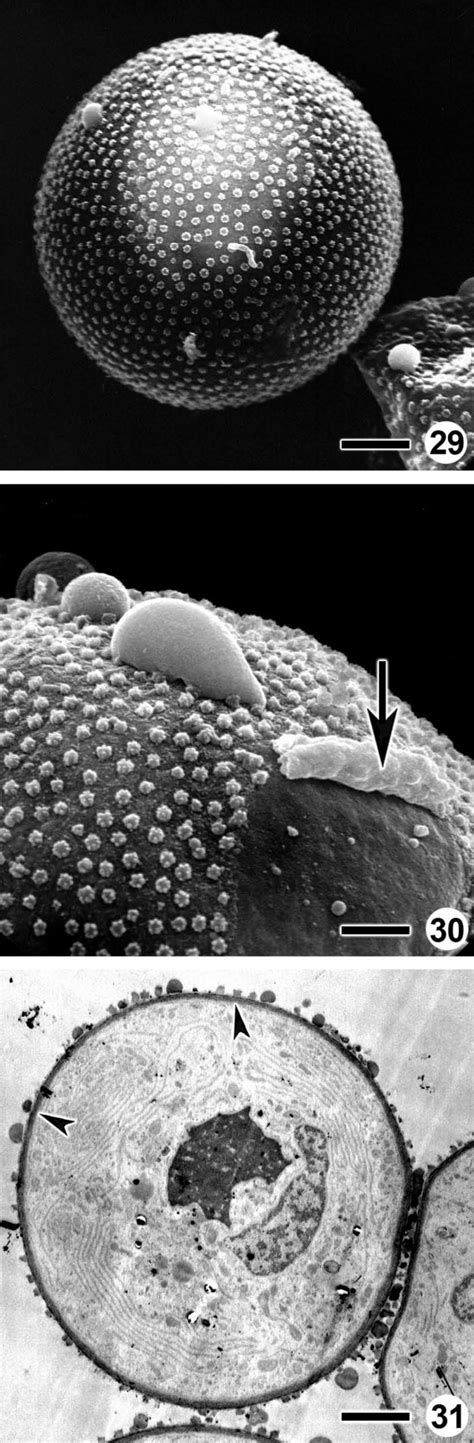 –31. Pollen grains structure. Fig. 29. Spheroidal inaperturate pollen ...