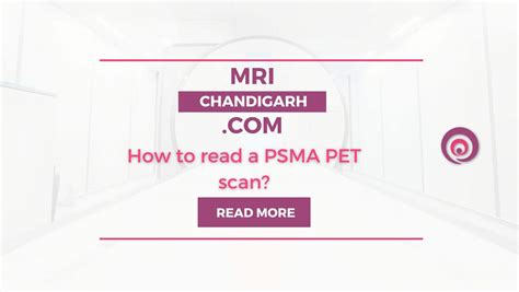 How to read a PSMA PET scan? - MRI Chandigarh