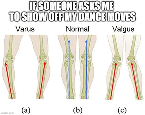 Varus Normal Valgus Repeat : r/medicalschool