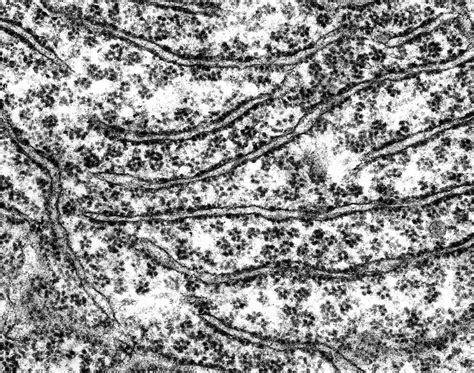 Ribosomes Electron Micrograph