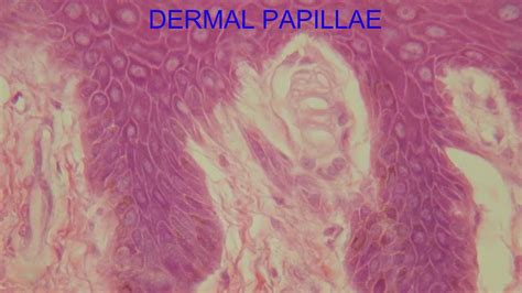 Dermal Papillae Histology