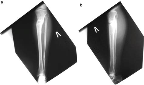 1 ( a , b ) X-ray imaging of the bones and adjacent joints | Download ...