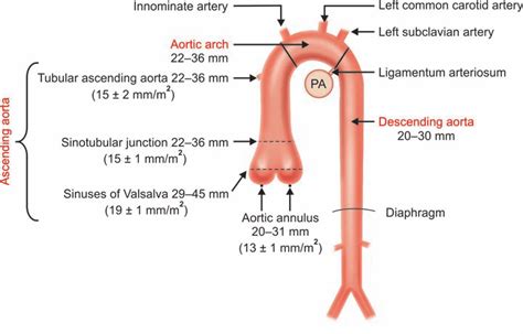 8 Aorta and its normal size range | Download Scientific Diagram