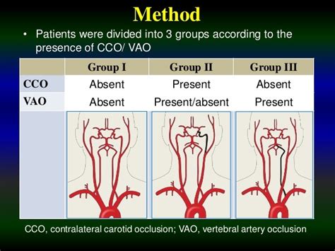 LP leaves child paraplegic // Vertebral artery CVA