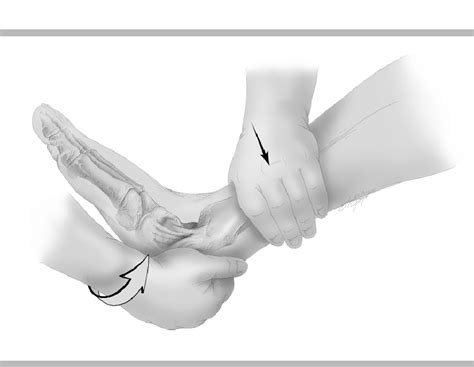 Anterior drawer test to assess the integrity of the anterior fibular ...