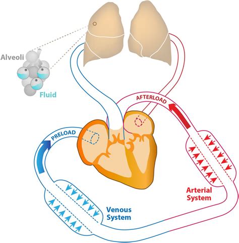 The pathophysiology of hypertensive acute heart failure | Heart