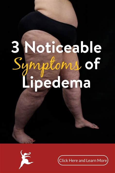 Pin on June: Lipedema Awareness Month