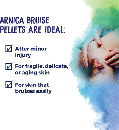 Boiron Arnica Bruise - Arnica Montana 30c for Relief of Pain Swelling ...