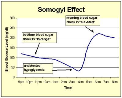 Undiagnosed diabetes symptoms weight loss, somogyi effect dawn ...