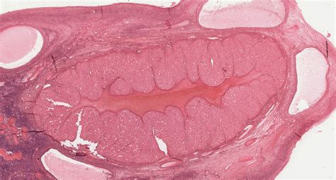 Female Reproductive System | histology